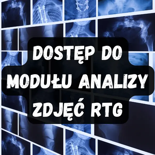 Dostęp do analizy zdjęć RTG klatki piersiowej – produkt cyfrowy Dostęp do modułu analizy zdjęć RTG klatki piersiowej (płuc) – zakup dostępu do analizy AI online