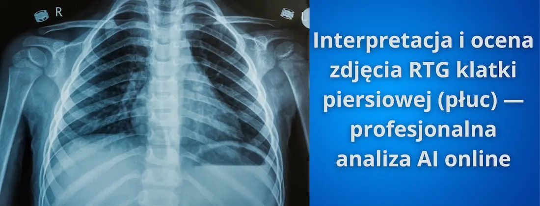 Interpretacja i ocena zdjęcia RTG klatki piersiowej — baner narzędzia do analizy AI online