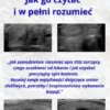 Okładka e-booka „Twój opis USG tarczycy – jak go czytać i w pełni rozumieć” z przykładami obrazów USG tarczycy i guzków