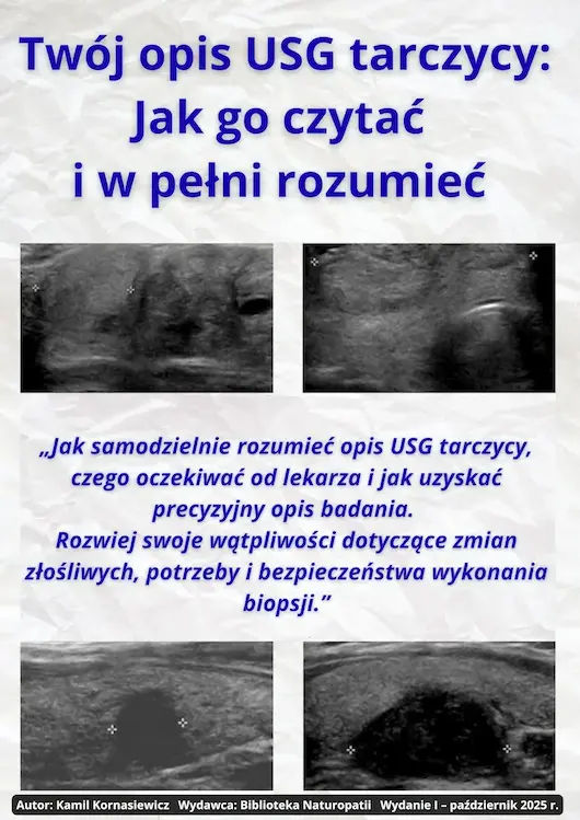 E-book: Twój opis USG tarczycy – jak czytać i w pełni rozumieć